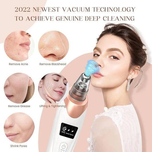 GlowPure™ 4-in-1 Pore & Blackhead Vacuum