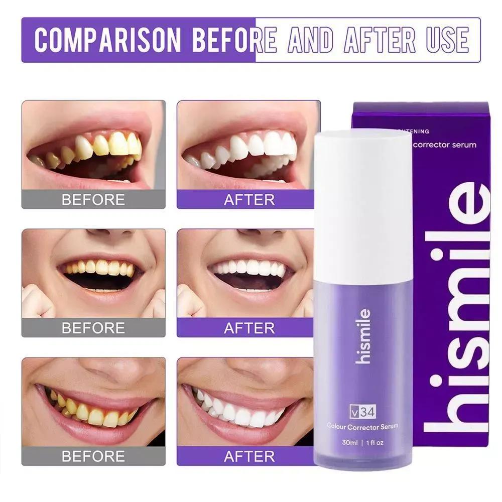 V34 Hismile Teeth whitening Serum