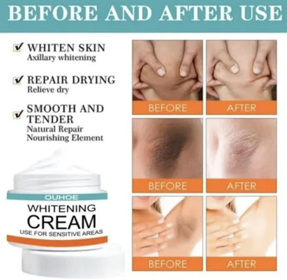 Whitening Creme-Dark Area Brightening Cream of private & sensitive parts